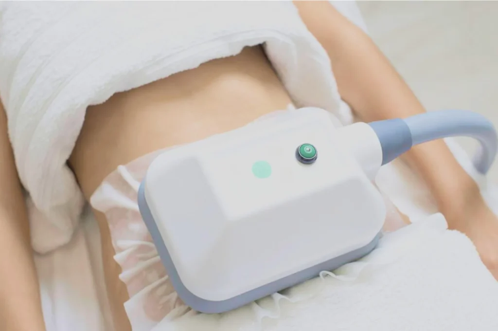 How Fat Freezing and HIFU Work Together? 3 advantages to combining Fat Freezing and HIFU Melksham