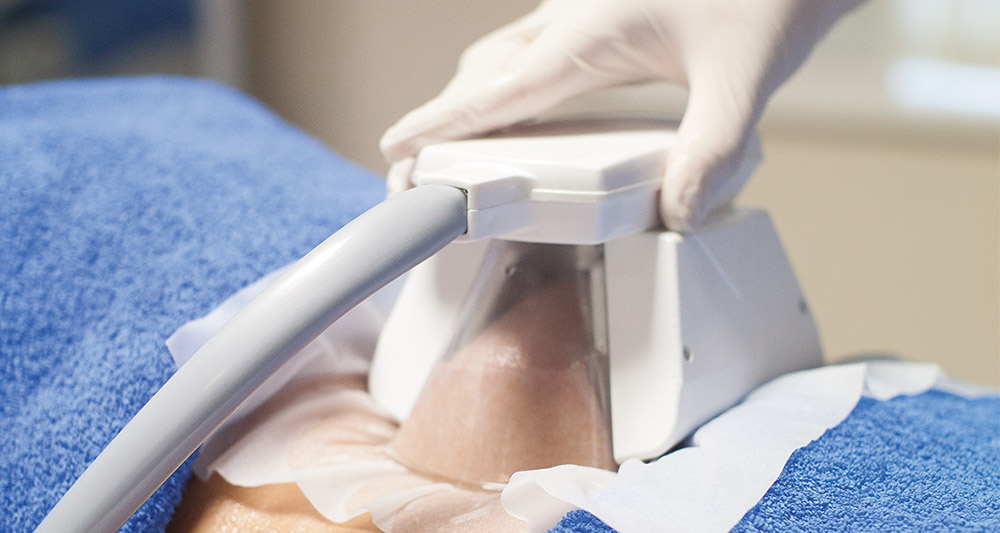How Fat Freezing and HIFU Work Together? 2 Multiple Areas in One Session HIFU and Fat Freezing Melksham