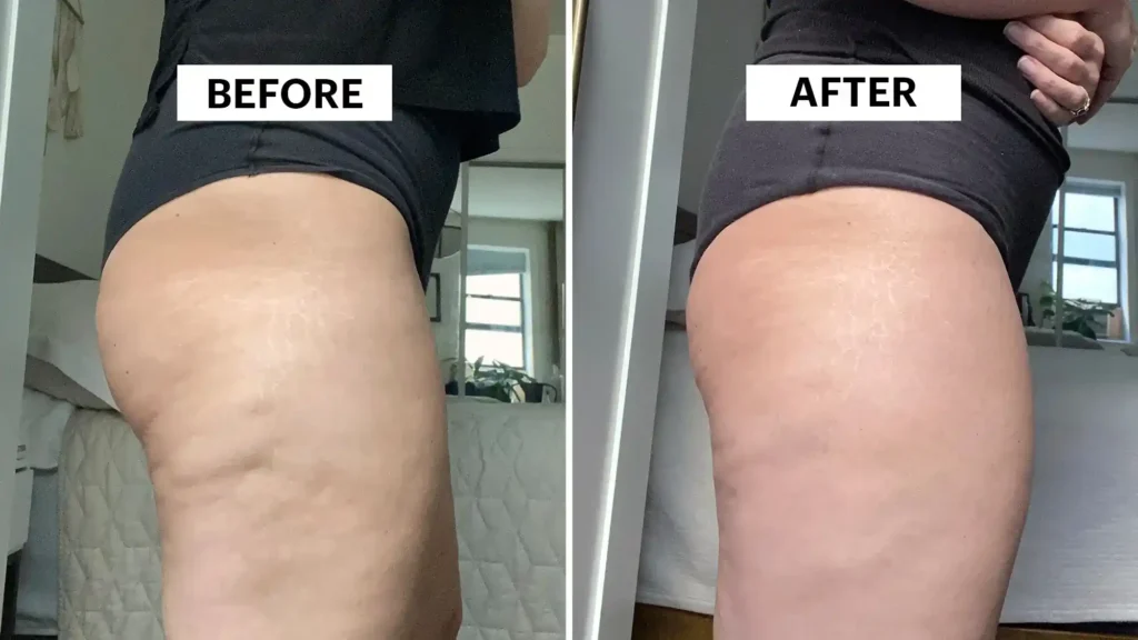 Do Toning Exercise Melksham Really Tackle Cellulite?