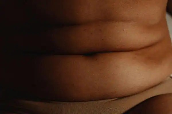 image of what stress can do on the stomach area and how Lipo 360 Melksham can help to change your body shape.