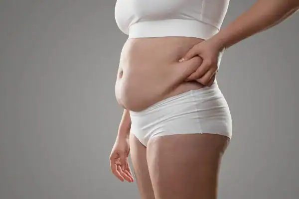 Image of stress belly Melksham How Lipo 360 can help manage your symptoms